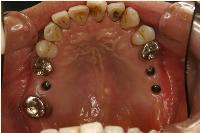 20141225222045.jpg