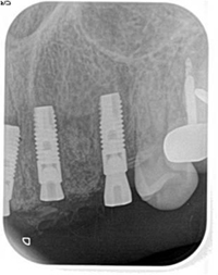 2014122620814.jpg