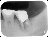 2015111101730.jpg