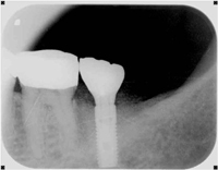 201511195352.jpg