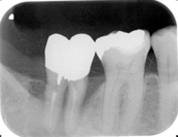 20151128476.jpg