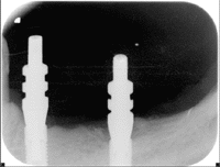 201511293848.gif