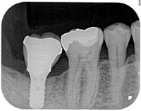 20151582435.jpg