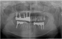 20151913183.jpg